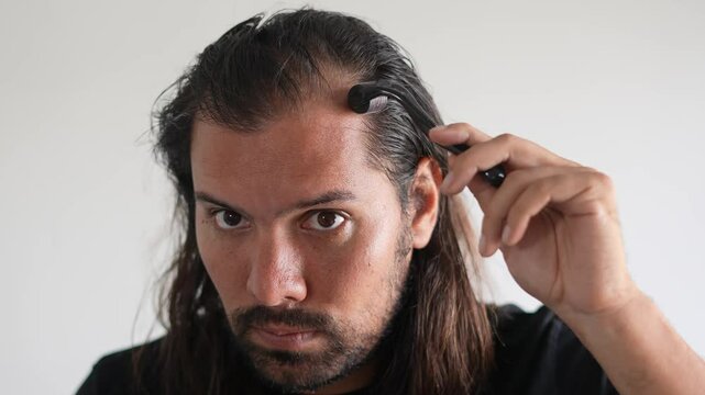 man wearing roller hair on his head to prevent baldness, DHT