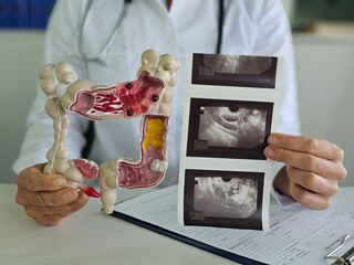Doctor Examining a Colon Model and Ultrasound Images