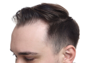 Fototapeta premium Baldness concept. Man with receding hairline on white background, closeup