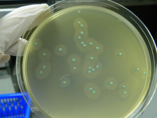 Blue-green surrounded by opaque halo colonies of Listeria on Aloa agar plate. Enumeration by spread plate method.