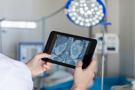 A doctor examines an X-ray on a tablet in a room .