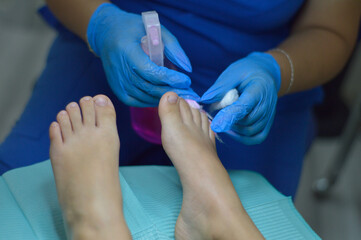 Pedicura clínico y exfoliante de pies uñas enterradas onicomicosis