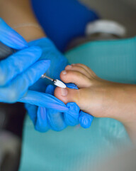 Pedicura cl&iacute;nico y exfoliante de pies u&ntilde;as enterradas onicomicosis