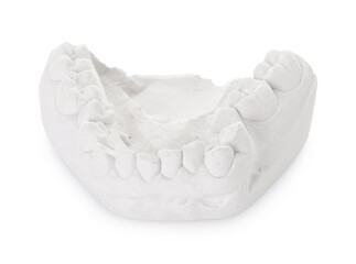 Dental model with gum isolated on white. Cast of teeth