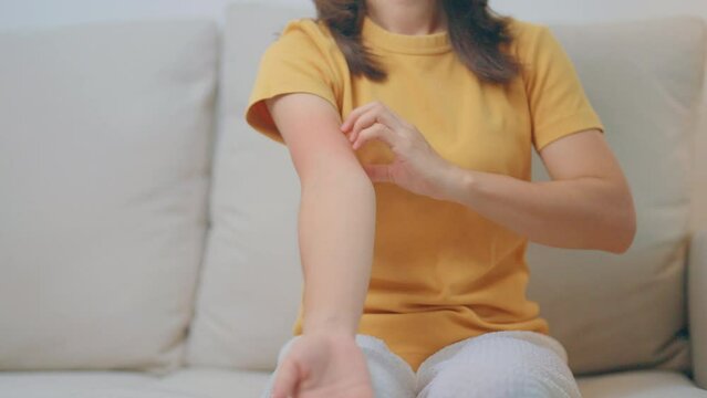 woman itching and scratching itchy arm. Sensitive Skin Allergic reaction to insect bite, food, drug dermatitis. Dermatology, Leprosy day, Systemic lupus erythematosus, Allergy symptoms and rash Eczema