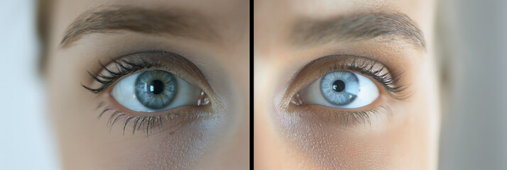 Naklejka premium close-up of human eyes, highlighting intricate iris patterns and delicate eyelashes. before after clear vision 