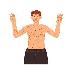 Man with Chickenpox Illustration vector