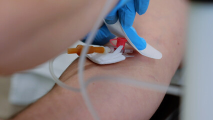 Medication flows through intravenous line into vein of patient's hand close-up. Intravenous therapy...