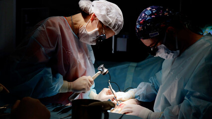 Dedicated surgeon with team of medical assistants meticulously operates on patient. High-tech...