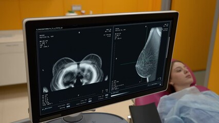 X-ray health examination of the patients breast at the hospital. X-ray inspection of the female patient health condition. X-ray mammography scanning of the patients chest for health analysis.