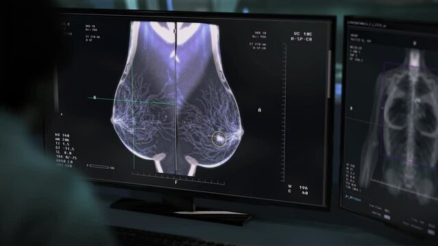 Performing the x-ray screening test on the sick patients chest. Mammography X-ray screening test examining the female breast. X-ray screening test diagnosing the dangerous cancer cells in the breast.