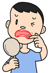 病気・疾病のイラスト - 口内炎・口腔粘膜疾患・できもの・腫物・炎症