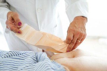 Female doctor exploring the stoma bag to a patient at hospital after colon cancer