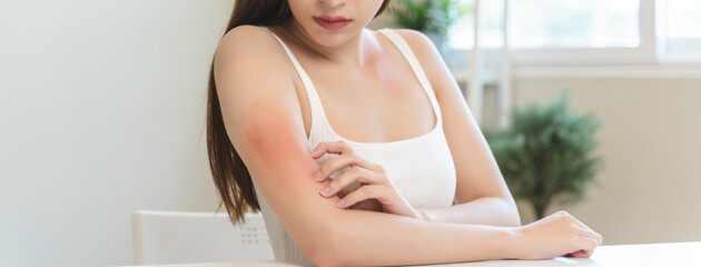 Sensitive skin allergic concept, Woman itching on her arm have a red rash from allergy symptom and...