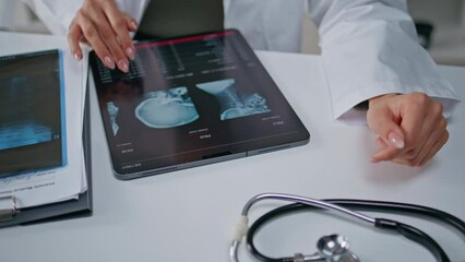 Doctor examining skull x-ray on tablet at hospital closeup. Physician hands