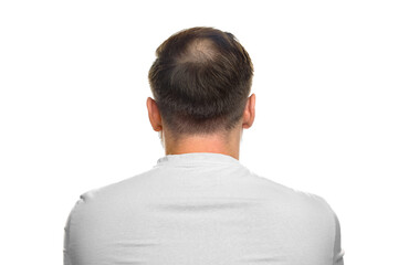 Baldness concept. Man with bald spot on white background, back view