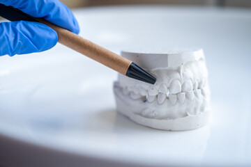 White plaster impression of the dental jaw of a patient with crooked teeth and malocclusion. Manufacturing of dentures and crowns based on orthodontic impressions