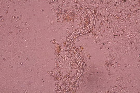 View in microscopic Strongyloides stercoralis or threadworm in human stool.Parasite infection.Medical background analyze by microscope, original magnification 400x