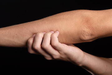 Young man scratching his arm with his hand. Skin disease. Irritation, allergy.