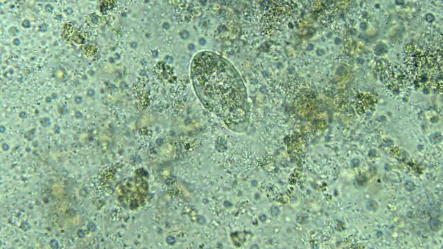 Microscopic examination of a water droplet reveals bacteria, microorganisms, and plants. High magnification view of paramecia and bacteria. Studying water for organic contamination.