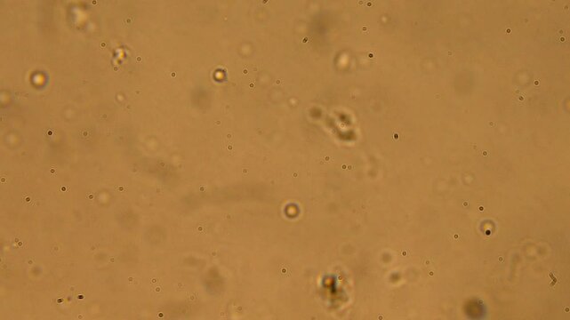 Life in a water droplet seen under a microscope. High magnification displays bacteria, paramecia, and other microorganisms. Laboratory examination for organic contamination in water.