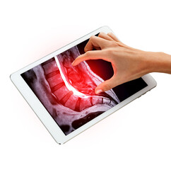 The image of a hand pointing at the  MRI L-S spine or lambar spine sagittal T2 technique  isplated...