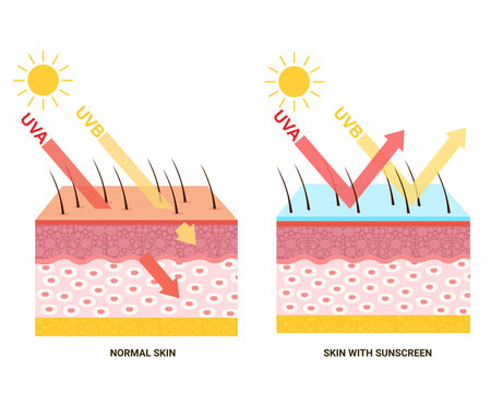 before and after Appling sunscreen Human skin protection from ultraviolet rays effect