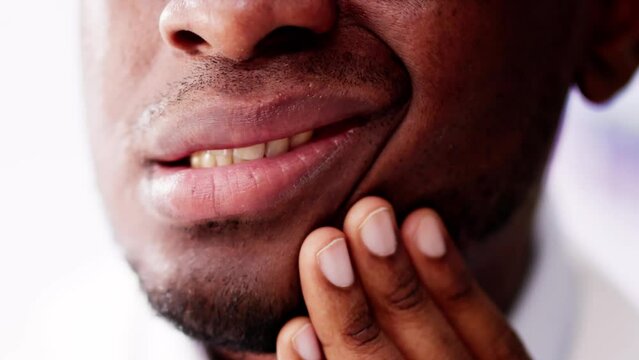 The Missing Tooth: A Portrait of Dental Decay