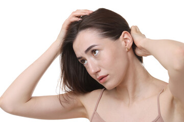 Naklejka premium Young woman with hair loss problem on white background