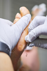 Podiatry. Removing calluses with a scalpel at the beautician