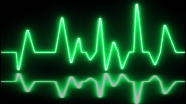 ECG with supraventricular premature beats and short paroxysms of neon atrial fibrillation animation.
