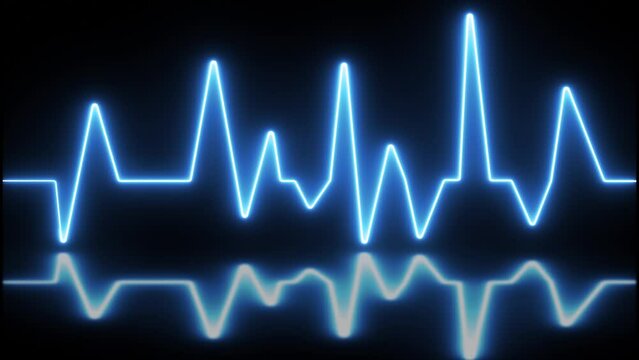 ECG with supraventricular premature beats and short paroxysms of neon atrial fibrillation animation.
