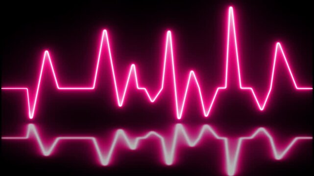 ECG with supraventricular premature beats and short paroxysms of neon atrial fibrillation animation.
