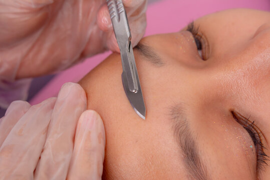 Close-up of dermaplaning or microplaning procedure to closely shave and exfoliating the skin.