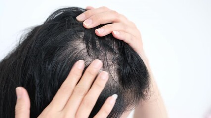 Asian woman parting her hair revealing hair loss or thinning hair.	
