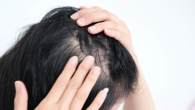 Asian woman parting her hair revealing hair loss or thinning hair.	