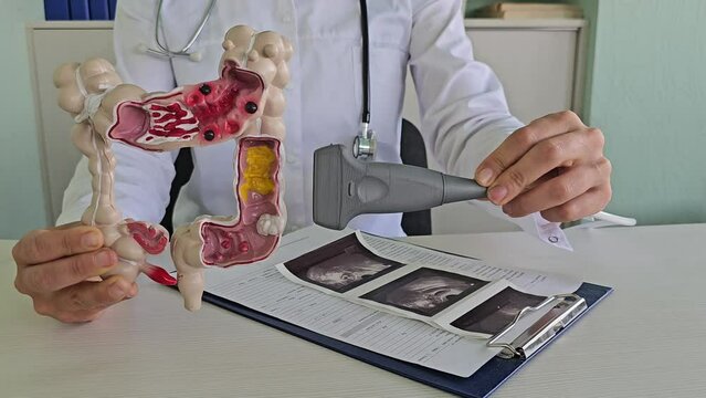 A doctor uses a model of the colon and an ultrasound probe to explain the anatomy of the colon to a patient