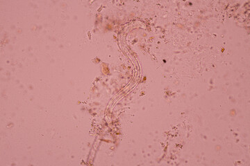 View in microscopic Strongyloides stercoralis or threadworm in human stool.Parasite...