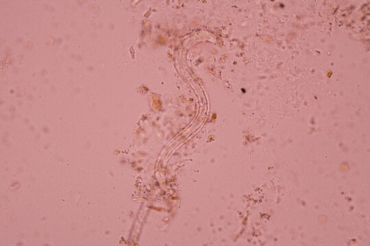 View in microscopic Strongyloides stercoralis or threadworm in human stool.Parasite infection.Medical background analyze by microscope, original magnification 400x