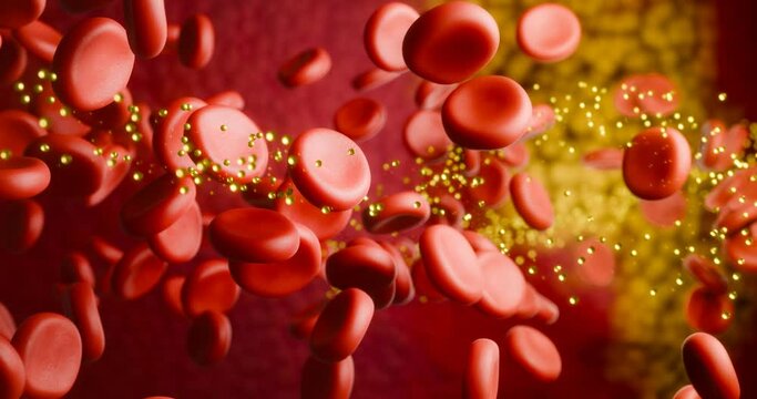 Hyperlipidemia or arteriosclerosis. Blocked artery concept and human blood vessel as a disease with cholesterol fat buildup clogging. Clogged arteries, Cholesterol plaque in the artery. 3D Rendering