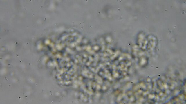 Microscopic life in a water droplet, including bacteria, microorganisms, and plants. High magnification view shows paramecia and bacteria. Lab study on organic contamination in water.