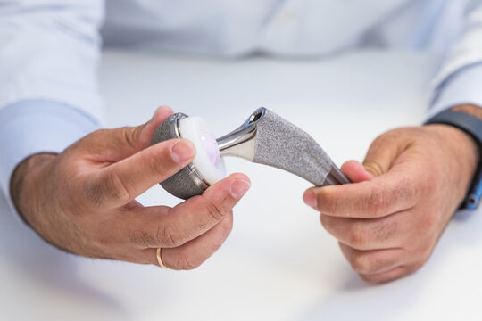Orthopedic Surgeon Demonstrating Hip Prosthesis