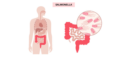 .Salmonella Typhimurium Cells