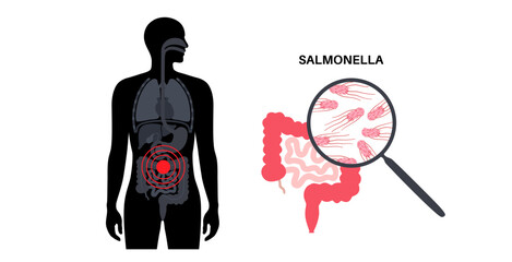 .Salmonella Typhimurium Cells