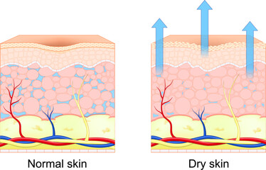 Dry and normal human skin.