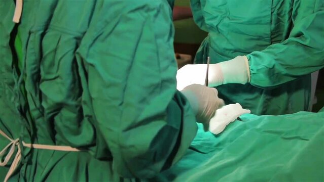 video footage of medical personnel wearing green clothes carrying out a surgical procedure on a patient