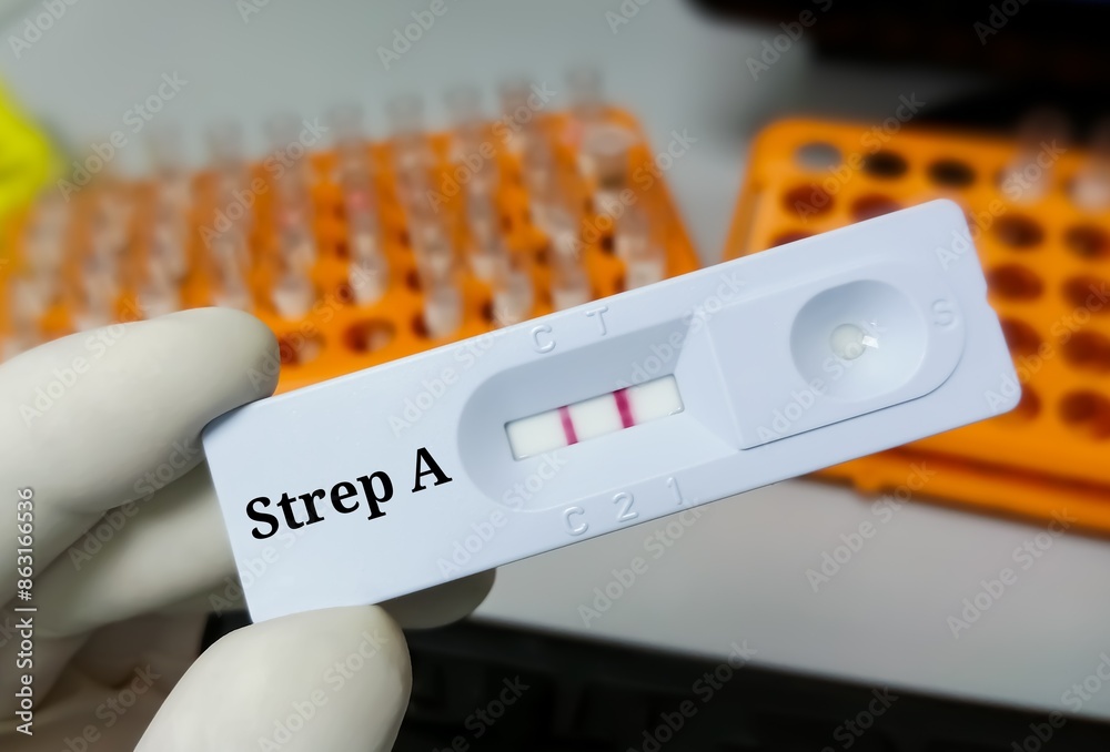 Poster rapid test cassette test showing positive for streptococcus group a (strep a)