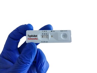 Rapid screening test for Typhidot test, to diagnose typhoid fever