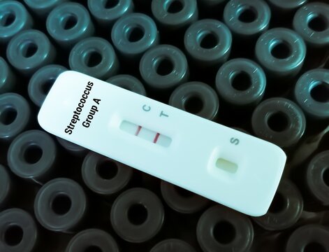 Rapid test cassette test showing positive for streptococcus group A (Strep A)