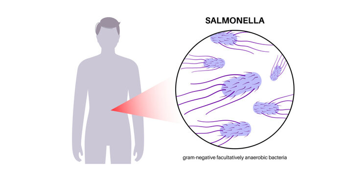 .Salmonella Typhimurium Cells
